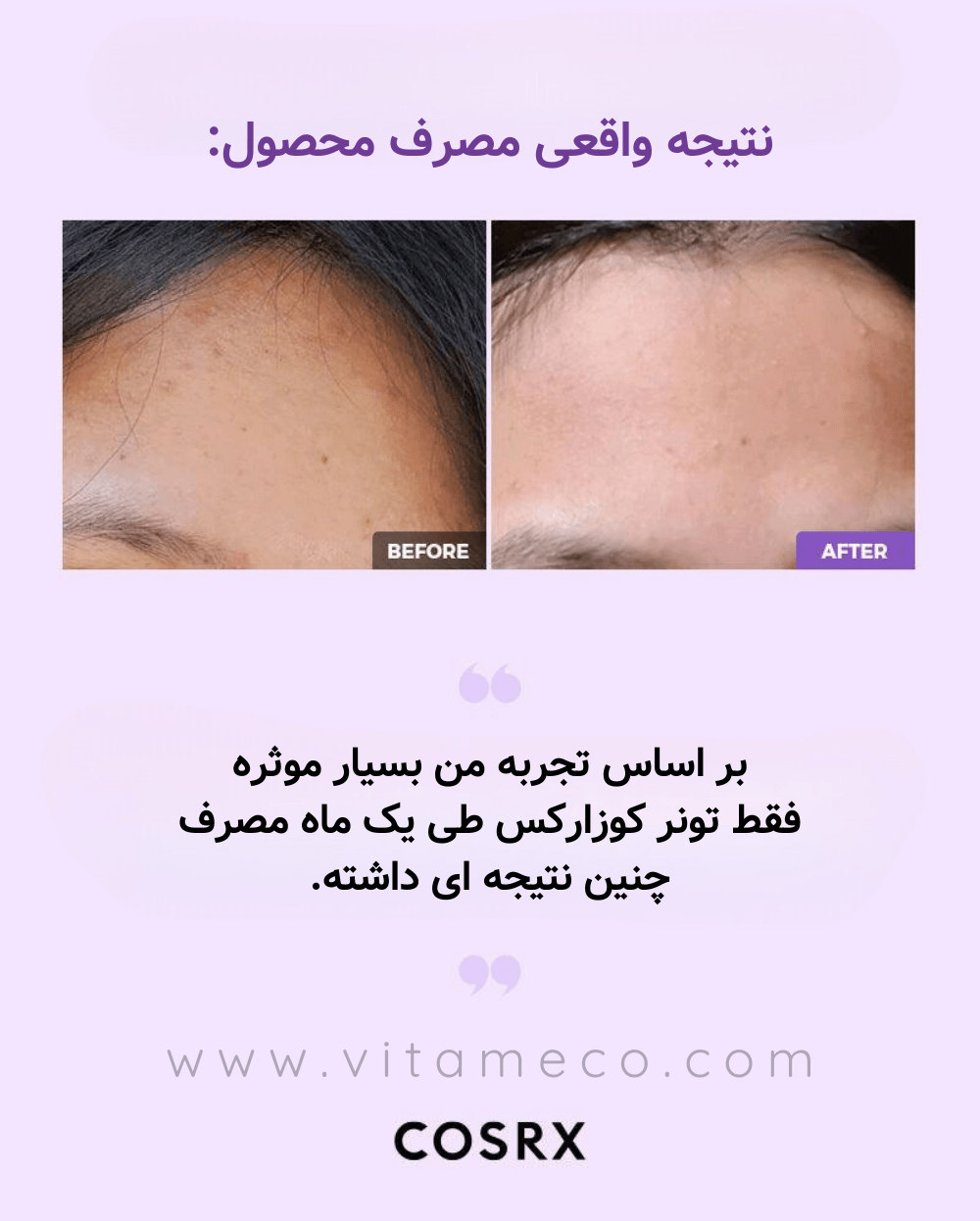 تونر بنفش کوزارکس
