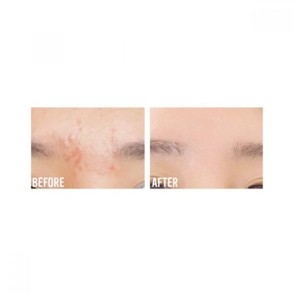 سرم درخشان کننده پروپولیس و نیاسینامید بیوتی اف جوسان Beauty Of Joseon Glow Serum Propolis Niacinamid | حجم ۳۰ میل - Image 2
