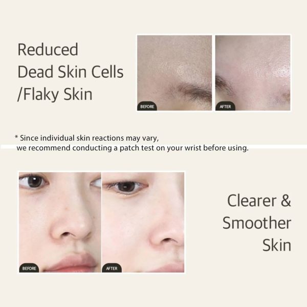اسنس سویا تخمیر شده میکسون Mixoon bean essence | حجم 50 میل - Image 5