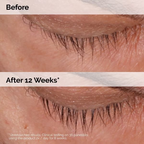 سرم تقویت مژه و ابرو مولتی پپتید اوردینری The ordinary multi peptide lash & brow serum - Image 3