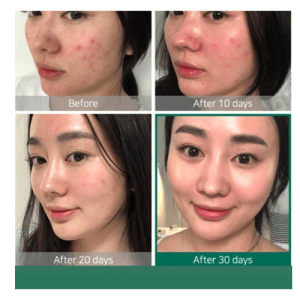 سرم لایه بردار پیلینگ اوردینری The ordinary AHA BHA Peeling solution حجم 30 میل - Image 3