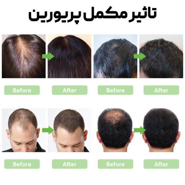 قرص پریورین بایر | تقویت کننده و قطع ریزش مو - Image 2