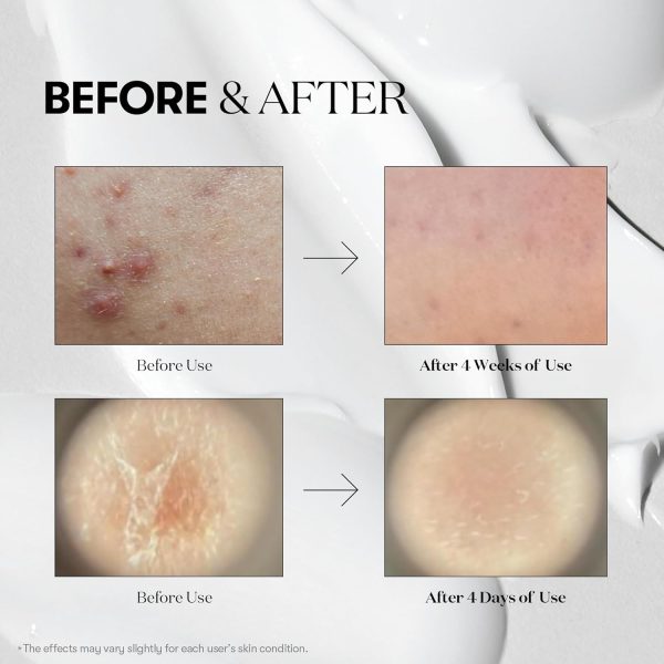 سرم میکرونیدلینگ ریدل شات 100 Vt Cosmetics حجم ۵۰ میل - Image 4