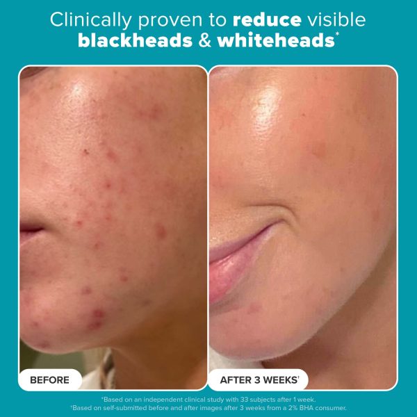 ژل شستشوی ضد جوش بلمیش کنترل سراوی CeraVe Blemish Control Cleanser - Image 3