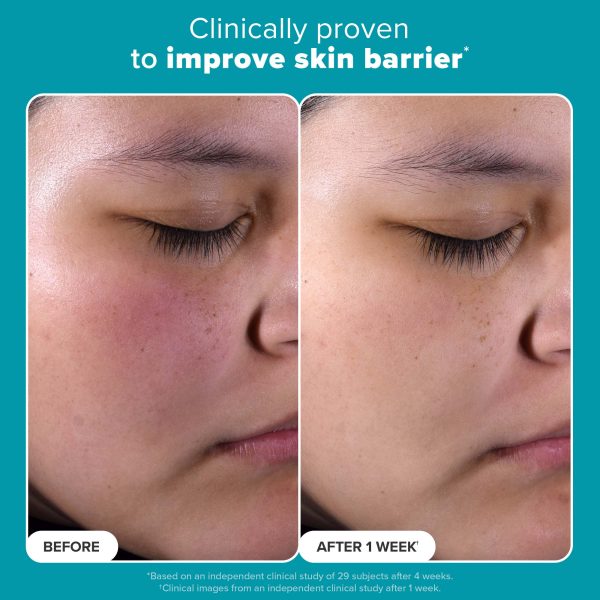ژل شستشوی ضد جوش بلمیش کنترل سراوی CeraVe Blemish Control Cleanser - Image 2
