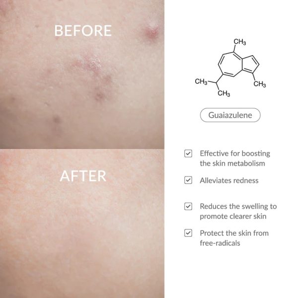 کرم بریر 147 دکتر التیا Dr Althia 147 barrier cream | تقویت و ترمیم سد دفاعی پوست - Image 3