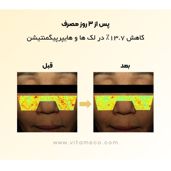 ماسک نیاسینامید و گلوتاتیون بایودنس Biodance | ماسک زرد ویتا نیاسینامید بایودنس - Image 3
